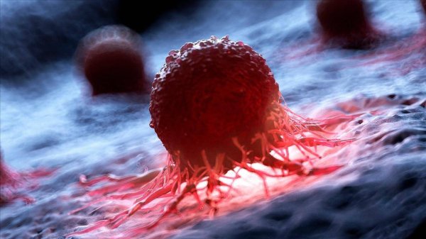 千里马配资 癌症挑人！专家揭秘易患癌特点，快看看你中了没？