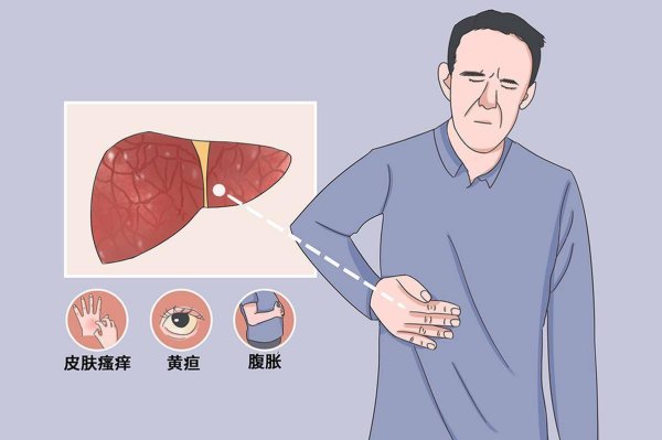 大资本优配 54岁女子查出肝硬化，天天吃蒸鸡蛋，复查获医生称赞：4点做得好
